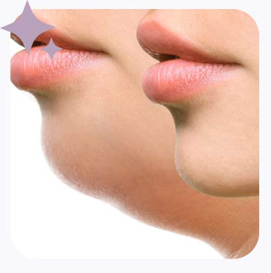 Como funciona esse procedimento?