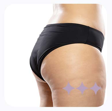 Para que serve a Radiofrequência?