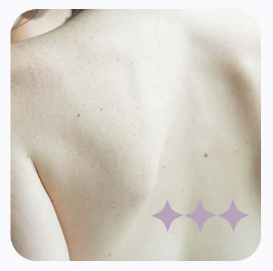 Para que serve esse procedimento?