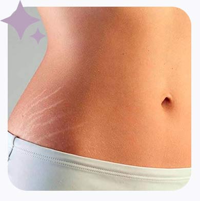 Como funciona esse procedimento?